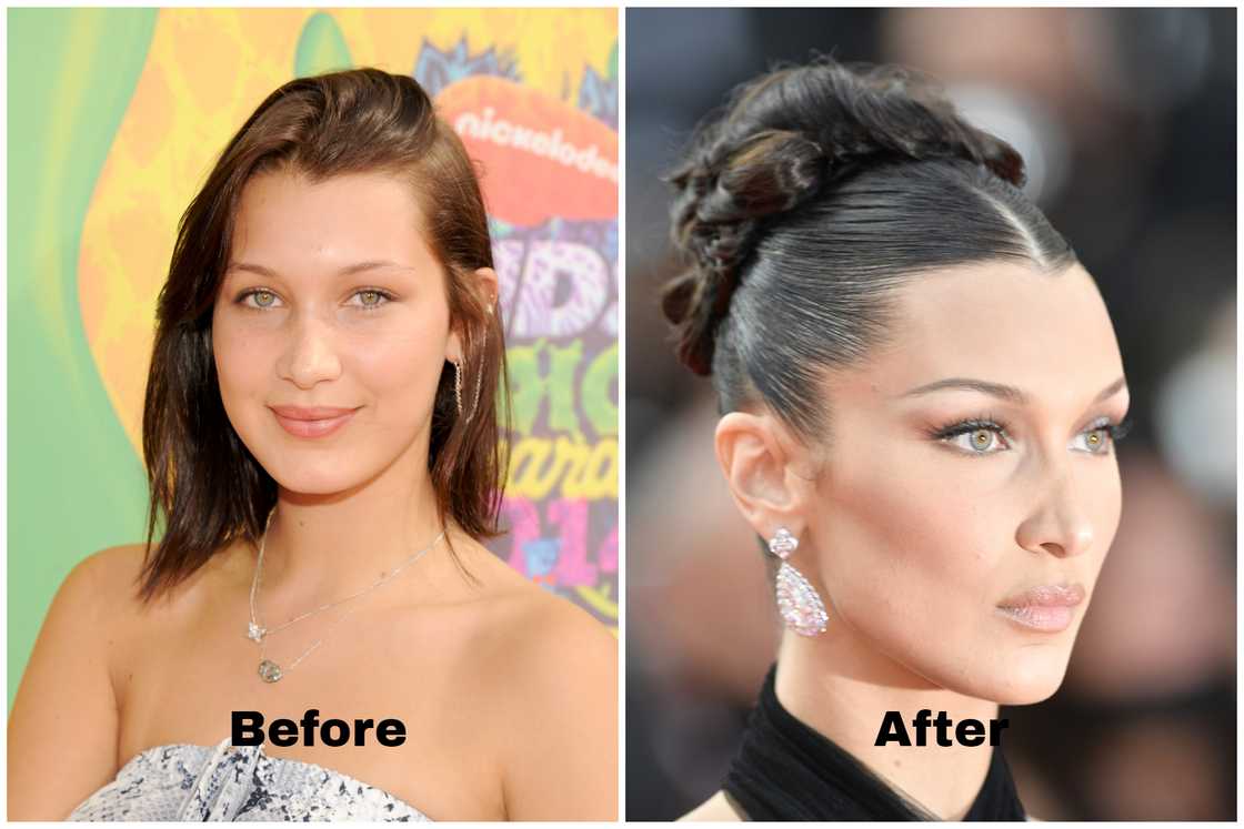Bella Hadid before and after Bella Hadid before and after