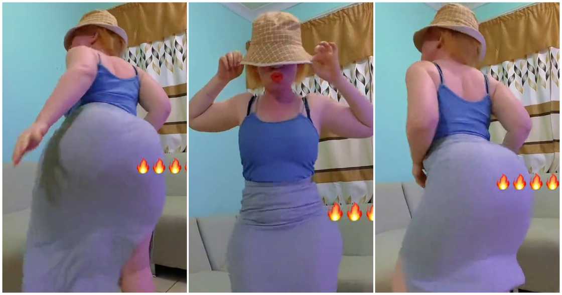 Albino dancer Lally Madia displays moves Albino dancer Lally Madia displays moves