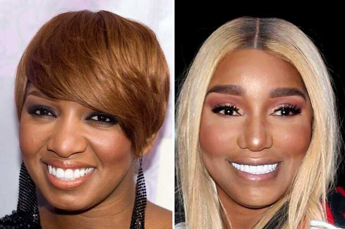 Celebrity nose jobs Celebrity nose jobs