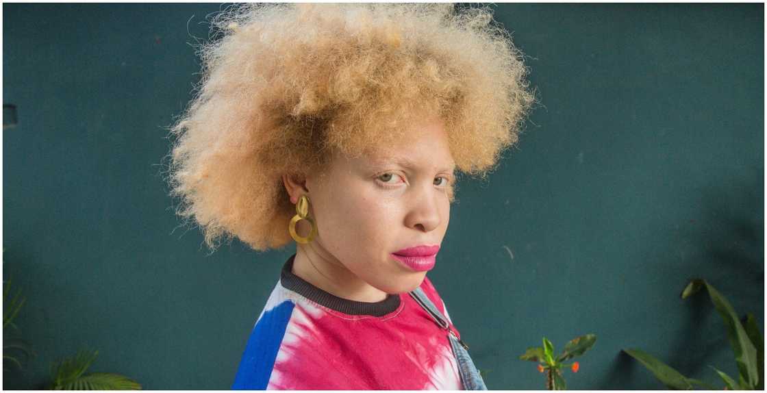 Albinism Awareness Day Albinism Awareness Day