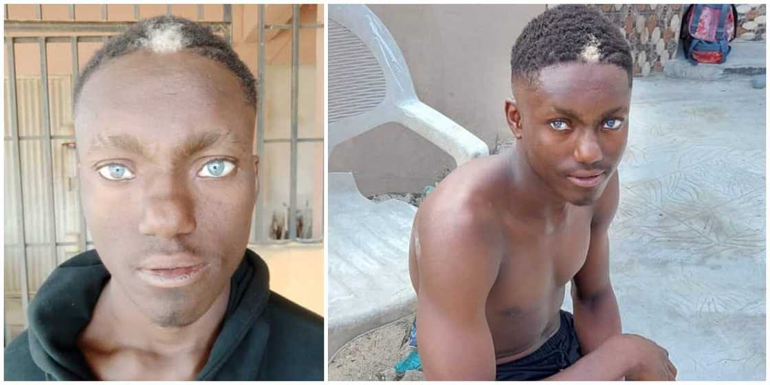 Photos of Nigerian man with natural frontal white hairs and light blue eyes causes stir on social media Photos of Nigerian man with natural frontal white hairs and light blue eyes causes stir on social media