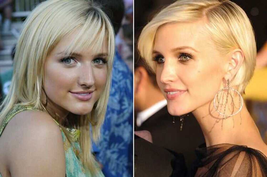 Celebrity nose jobs Celebrity nose jobs