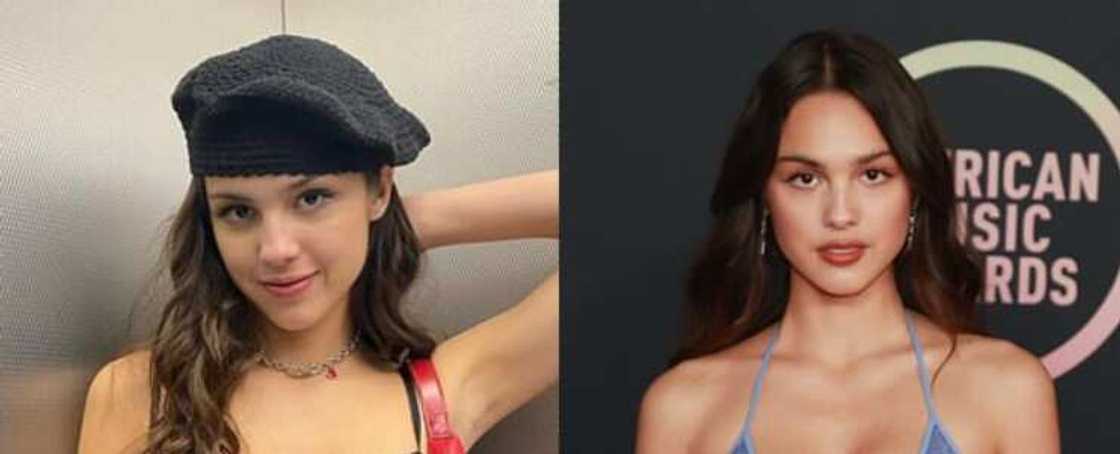 Celebrity blepharoplasty before and after Celebrity blepharoplasty before and after