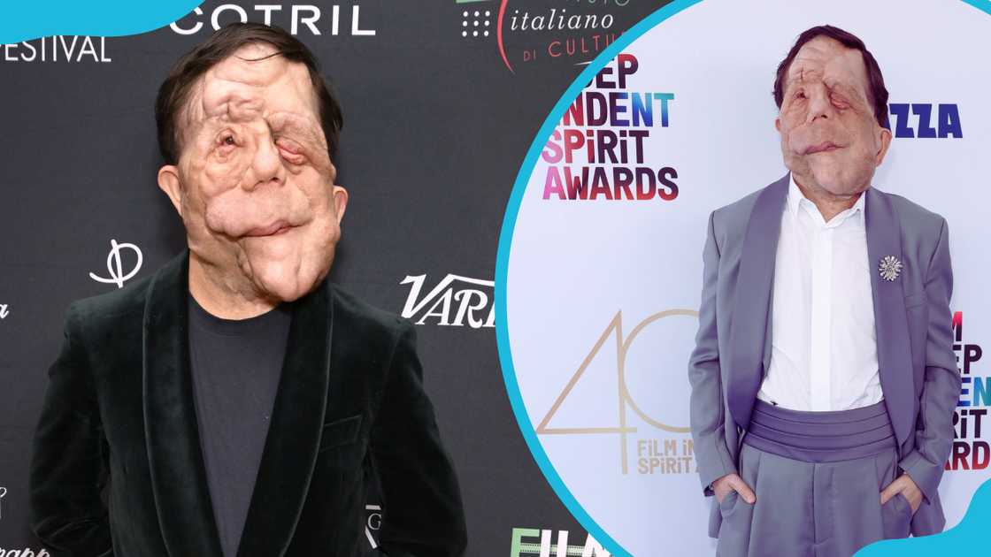 Adam Pearson is seen at the closing night of the 10th annual Filming Italy Los Angeles festival (L). He attends the 2025 Film Independent Spirit Awards (R) Adam Pearson is seen at the closing night of the 10th annual Filming Italy Los Angeles festival (L). He attends the 2025 Film Independent Spirit Awards (R)