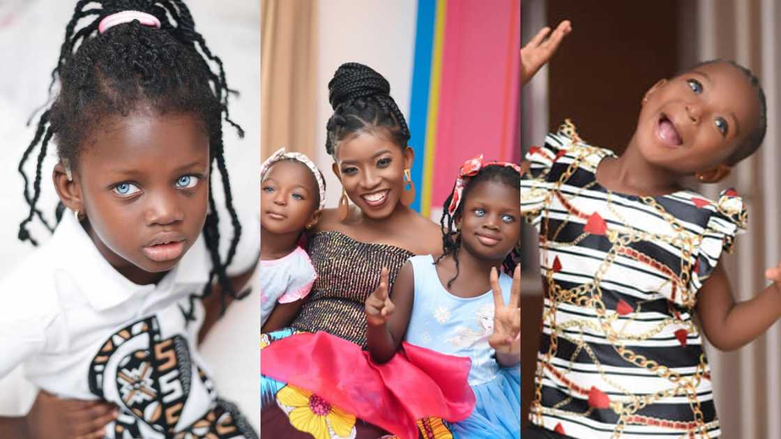 2 adorable Ghanaian kids in need of surgery wear bright smiles on b'day