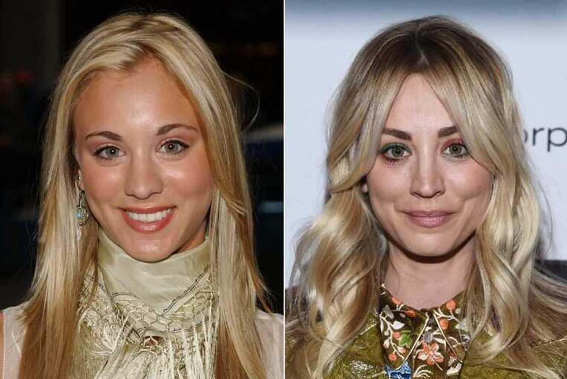 Celebrity nose jobs Celebrity nose jobs