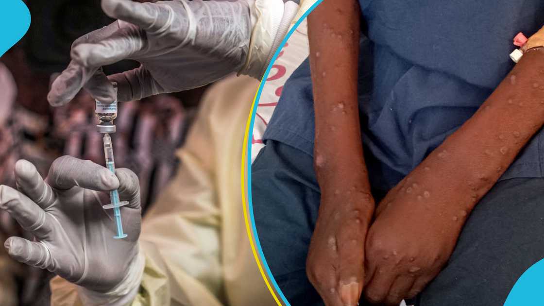 Mpox, Increase cases, GHS, Ghana Health Service, 409, Public health Mpox, Increase cases, GHS, Ghana Health Service, 409, Public health