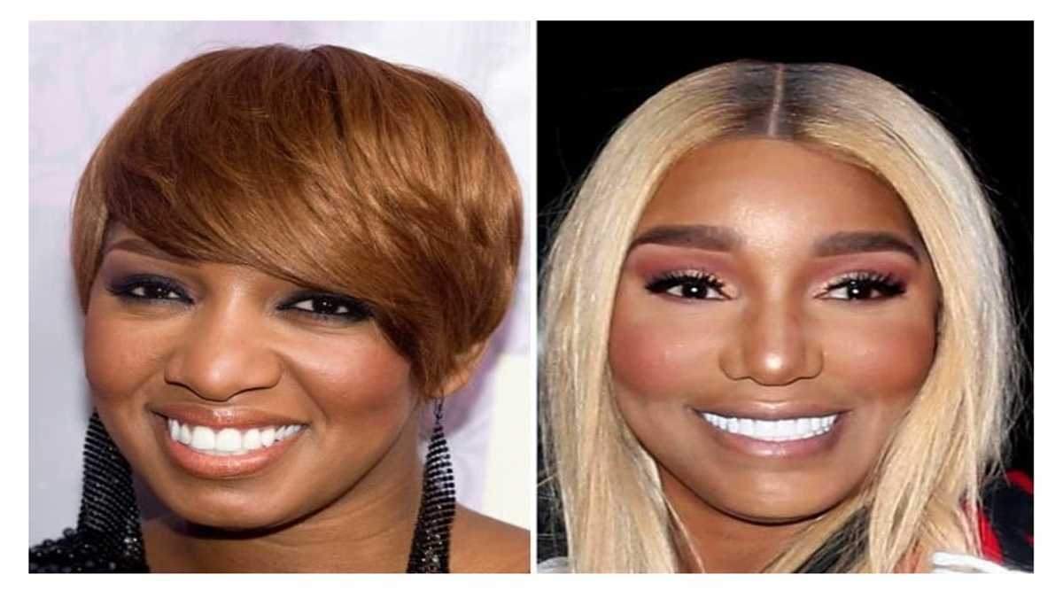 Celebrity Nose Jobs Before And After Rhinoplasty