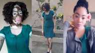 9 photos of Ghanaian nurse with vitiligo that summarize her skin transformation