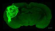 Human brain cells implanted in rats offer research gold mine