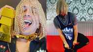 Rapper gets gold chains surgically implanted into his scalp