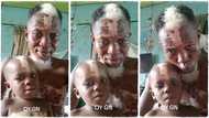 "No need for DNA test": Man with white marks on his face and body shows his son who has same marks