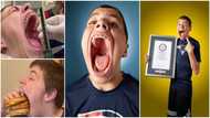 Meet teen with the widest mouth; can hold apple, can and Baseball in it at once