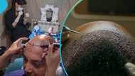 Hair transplants coming to Ghana, University of Ghana Medical Centre to offer service