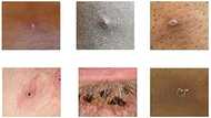 Monkeypox vaccine maker Bavarian Nordic ready to meet demand