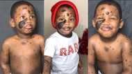 Angelic photo of little boy with unique skin goes viral; stirs massive reactions