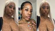 "She's a work of art": Black lady posts her body on Twitter, displays freckles on her skin, people react