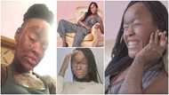 Meet pretty 21-year-old lady whose skin sheds every 10 days, she doesn't sweat at all