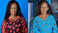 Lady with facial palsy shares her survival and gratitude story on social media; many show her 
massive love