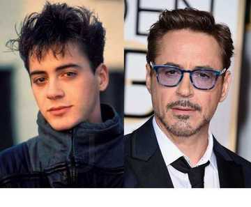 Celebrity blepharoplasty before and after: 10 celebrities that have had