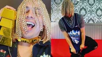 Rapper gets gold chains surgically implanted into his scalp