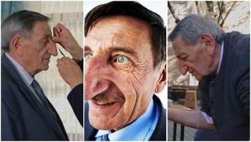 My friends used to laugh at me: Man with world's longest nose speaks in viral video, stirs reactions