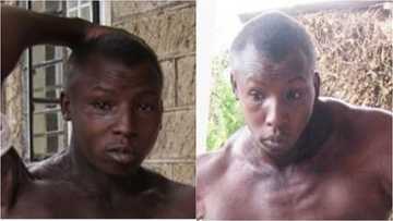 Sadness as 30-year-old bodybuilder dies after suffering body disfigurement from dangerous substance (photo)