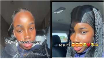 Young black lady gushes over new look after successfully undergoing forehead surgery