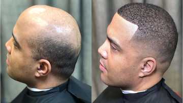 Bald-headed men around the world now rock wigs, say goodbye to baldness