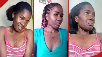 Kenyan Woman with beard, chest hairs says she faced stigma forcing her to shave