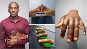 Man Creates Artificial Fingers, Legs, Hands for Dark Skin, Photos Wow People