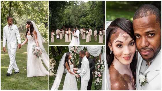 Man ties the knot to lady with vitiligo; photos of their wedding go viral