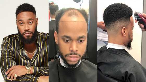 This solution for bald men might become the future of hair-making (Photos)