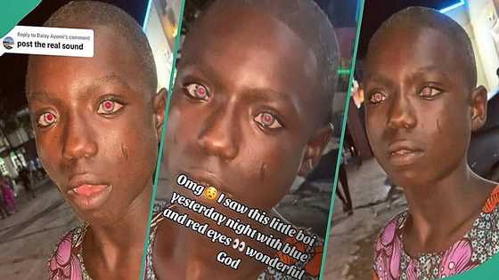 Lady captures Nigerian boy with red and blue eyes, his video goes viral