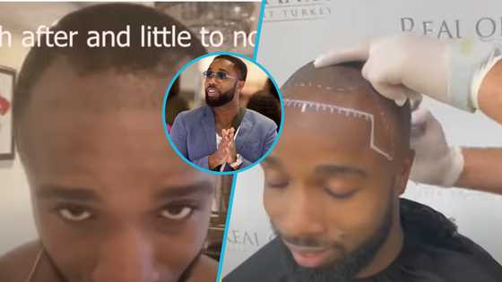 Harold Amenyah flaunts his new look after his expensive hair transplant in Turkey: "I was very insecure"