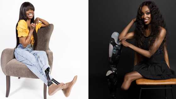 Pretty lady who lost her legs, fingers after falling sick becomes a model, beautiful photos pop up