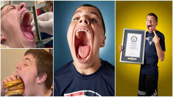 Meet teen with the widest mouth; can hold apple, can and Baseball in it at once