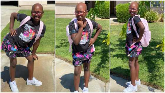Mom flaunts her daughter living with alopecia; photos of girl's 'sakora' head sparks reactions