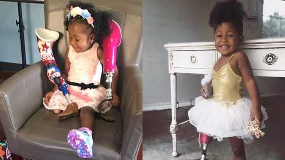Meet the black girl with 1 leg who became an excellent runner at age 2