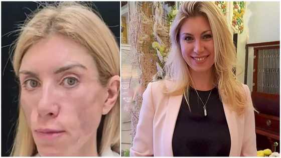 Beauty queen unable to close her eyes or smile after she had plastic surgery to look young