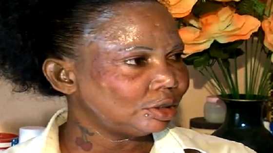 Kidney, fertility problems alert: FDA warns against use of 41 popular but harmful cosmetic products