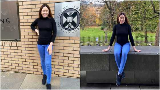 Lady who graduated with 1st class twice despite visual impairment affecting albinos bags masters scholarship