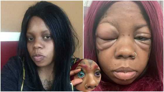 Gorgeous lady who tattooed her eyeballs blue risks going blind, sad story triggers fans to react