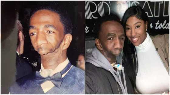 Joseph Williams: Man born without jaw marries beautiful lady after giving up on finding true love