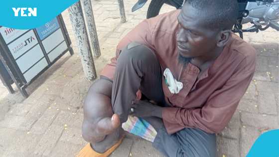 Despite his strange giant arm, he refuses to give up - The inspiring story of a Ghanaian beggar