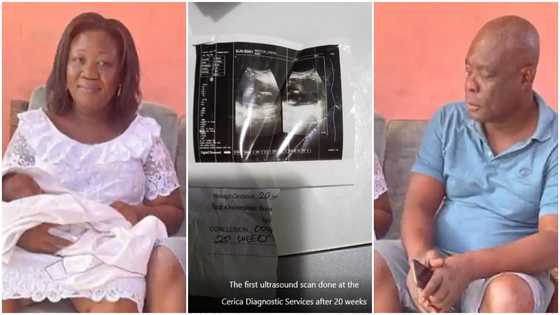 37 apologizes to couple whose scans showed 2 babies but were given only 1 during delivery