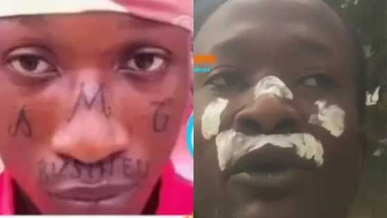 Die-hard Medikal fan who tattooed "AMG" on his face 'cleans' it over neglect in video